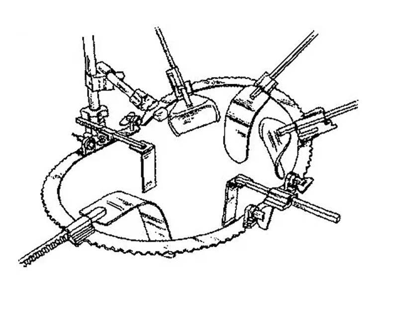 Omni-directional retractor