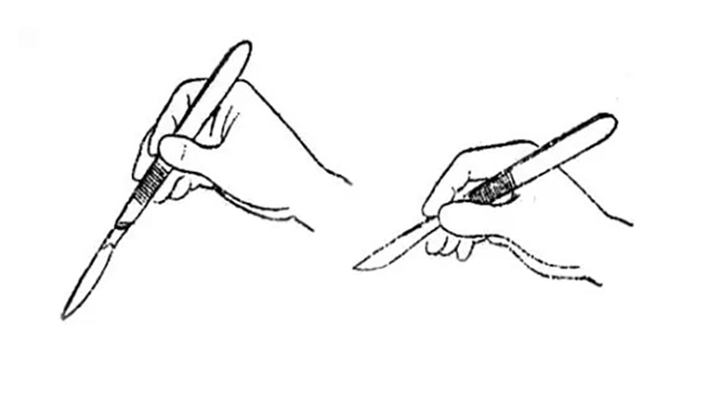 Wrong way of holding the scalpel