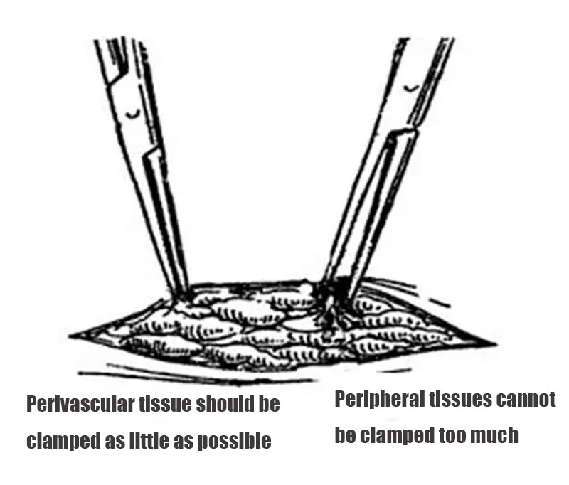 Correct posture for holding surgical scissors